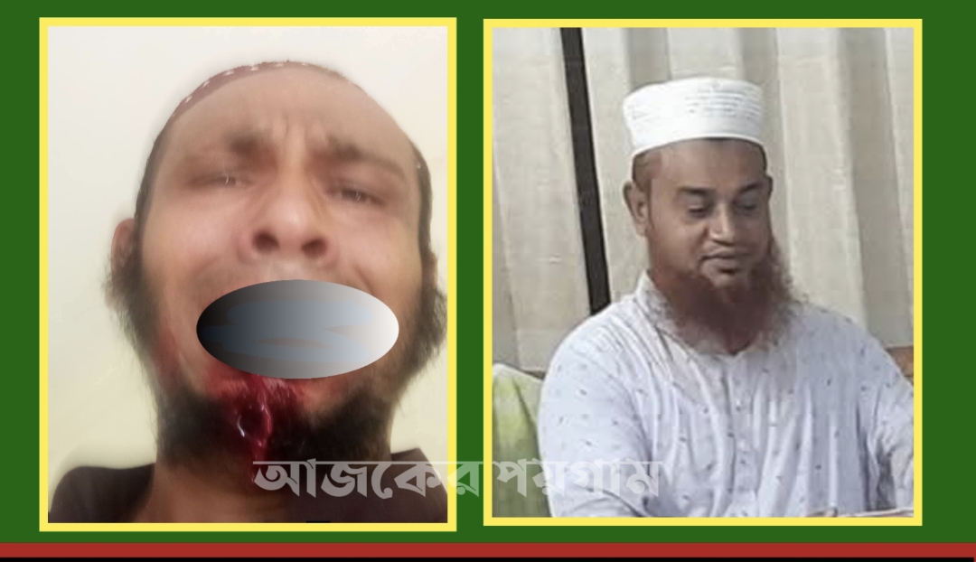 অধ্যক্ষের এক ঘুষিতে কম্পিউটার অপারেটরের দুই দাঁত হারালেন!